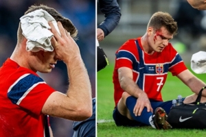 世体：瑟尔洛特头部受伤出战巴萨存疑，马竞周四评估球员情况