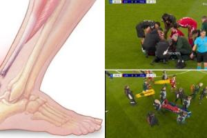 世界杯危!康复专家:埃基蒂克可能是跟腱断裂,将缺席9-12个月